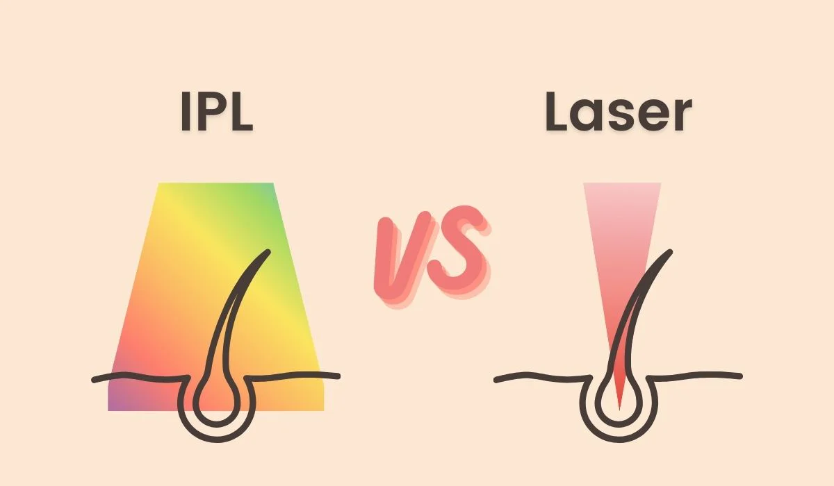 Fördelarna med Laser & IPL Hair Removal Devices