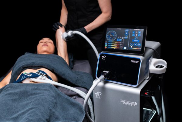 Terapeut behandlar kund med Cryo T-Shock på klinik